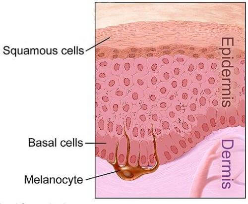 T-Rays Offer Potential for Earlier Diagnosis of Melanoma
