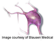 BRAF inhibitor