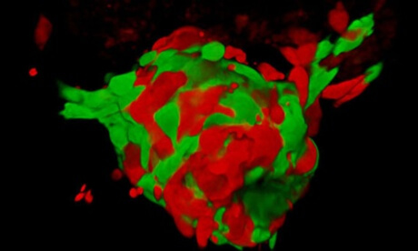Tumour in Zebrafish