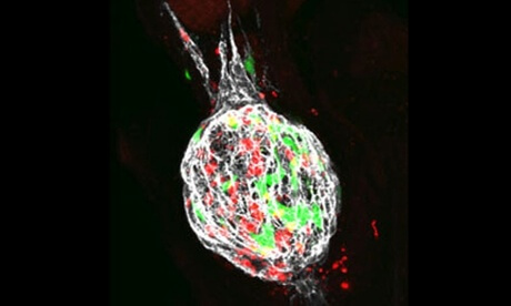 zebrafish melanoma tumour