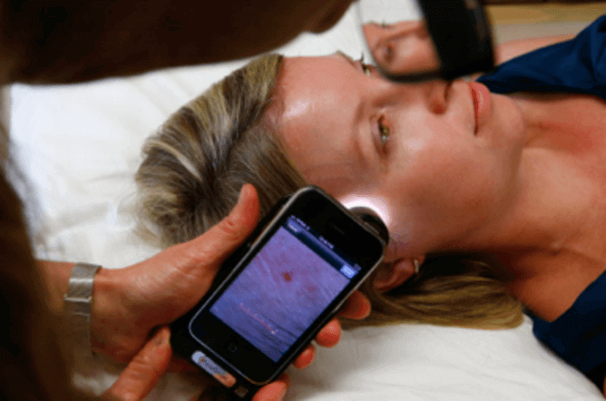 Mobile teledermoscopes attach a light source and magnifying lens to a smartphone Source; The Conversation