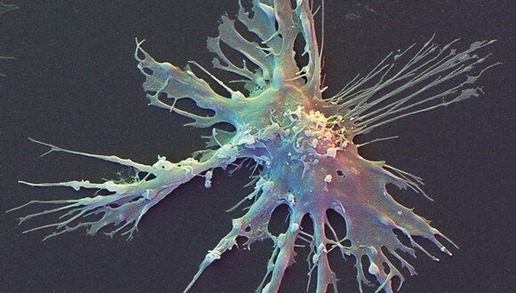 Source: David Scharf / Science Photo Library Researchers have created personalised vaccines for patients with advanced melanoma by incubating a sample of each patient’s dendritic cells (pictured) with a chosen set of antigens Source: Pharmaceutical Journal